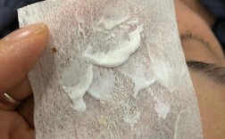 海藻面膜加什么能祛痘印？