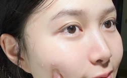 洗脸用水真能祛痘？