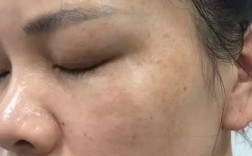 皮肤不吸收护肤品怎么办？