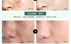 玛茜护肤品有副作用吗？