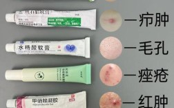 痘痘肌选什么护肤品？