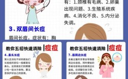 如何快速祛痘消灭？