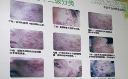 祛痘机构排行榜10强