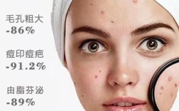 痘痘肌护肤品怎么选才有效？