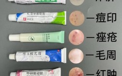 粉刺针祛痘安全吗？会不会留疤？