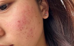 护肤品用后脸泛油，是哪步出错了？