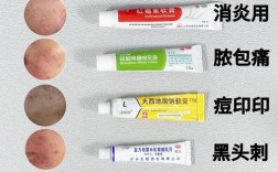 脸上有痘痘，护肤品该怎么选？