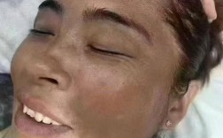 护肤品汞超标会怎么样