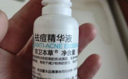 口服控油祛痘选什么好？