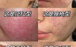 脸上过敏后，护肤品还能用吗？