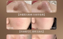 卸妆祛痘洗脸淡斑，如何一招搞定螨虫问题？