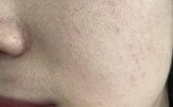 护肤品浮脸不吸收怎么办？