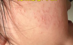 换护肤品脸上长小米粒