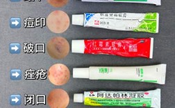 祛痘去粉刺什么产品最有效？