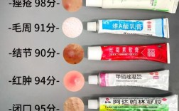 祛痘膏激素有什么害处