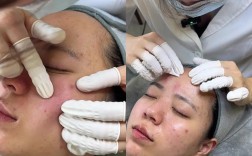 Lisa Eldridge祛痘真有效吗？