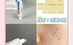 pair祛痘膏含哪些有效成分？