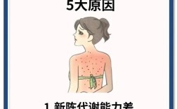 扛油扛痘是祛痘的意思吗？