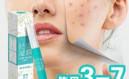 云南白药祛痘膏效果真的好吗？