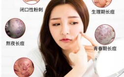 瓷肌祛痘套装怎么用？