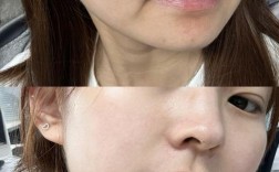 护肤品涂完脸黏腻怎么办？