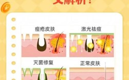 光疗祛痘需先排痘吗？