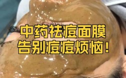 敷什么中药面膜能祛痘