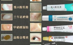 安利化妆品祛痘祛粉刺真的有效吗？