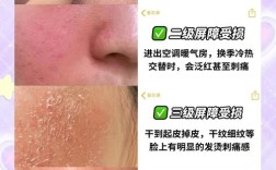 护肤品过敏了，该怎么办？