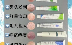 祛痘膏怎么选？最好又最便宜的有没有？