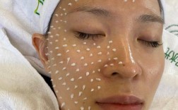 钻石微雕祛痘真能彻底根除吗？