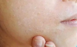 护肤品擦完脸粘粘的怎么办？