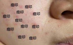 祛疤哪种方法最有效？