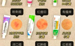 祛痘祛痘印产品怎么选才好用？