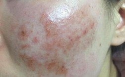 护肤品里加什么会毁容？