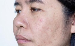 护肤品用后皮肤更差，为何？