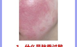 脸过敏了还能用护肤品吗？