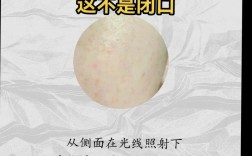 强脉冲光到底能不能祛闭口痘？