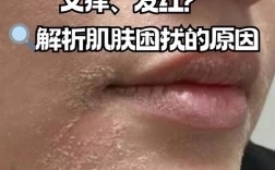 新换护肤品皮肤不适应