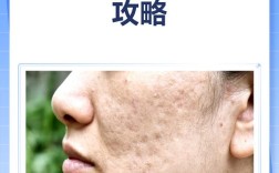 护肤品过敏后能自行恢复吗？