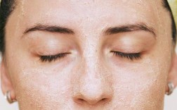 油皮祛痘真不用保湿吗？