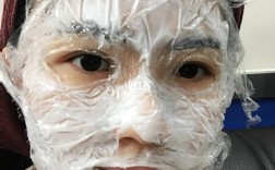 激光祛痘印麻药怎么敷才有效？