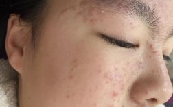 肌龄护肤品有严重问题