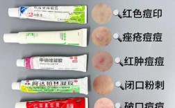 祛痘和痘印，哪个牌子更有效？