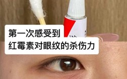 红霉素眼膏真能祛痘印吗？