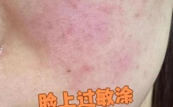 过敏肌护肤品怎么选？