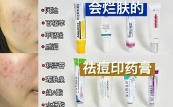 祛斑去痘印，什么方法最有效？