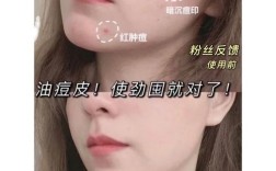 瓷妆祛痘效果到底好不好？