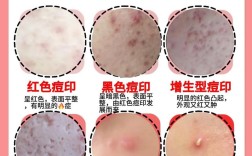 男生祛痘印的日常方法