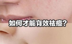 男士祛痘印最快方法是什么？